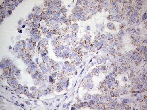 PIK3CD Antibody in Immunohistochemistry (Paraffin) (IHC (P))