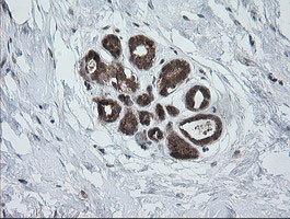 PIK3CG Antibody in Immunohistochemistry (Paraffin) (IHC (P))