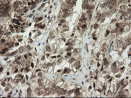 PIK3CG Antibody in Immunohistochemistry (Paraffin) (IHC (P))