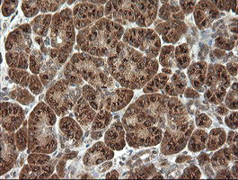 PIK3CG Antibody in Immunohistochemistry (Paraffin) (IHC (P))