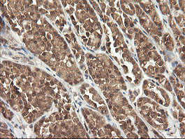 PIK3CG Antibody in Immunohistochemistry (Paraffin) (IHC (P))