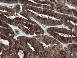 PIK3CG Antibody in Immunohistochemistry (Paraffin) (IHC (P))