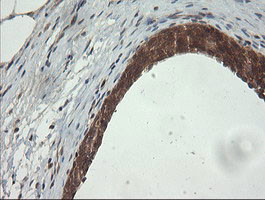 PIK3CG Antibody in Immunohistochemistry (Paraffin) (IHC (P))