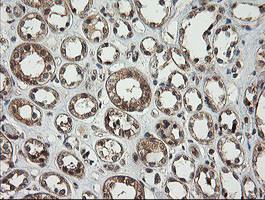 PIK3CG Antibody in Immunohistochemistry (Paraffin) (IHC (P))