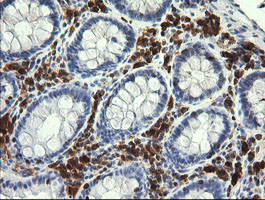 PIK3CG Antibody in Immunohistochemistry (Paraffin) (IHC (P))