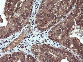 PIK3CG Antibody in Immunohistochemistry (Paraffin) (IHC (P))