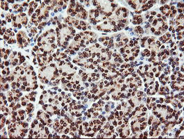 PIK3CG Antibody in Immunohistochemistry (Paraffin) (IHC (P))