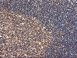 PIK3CG Antibody in Immunohistochemistry (Paraffin) (IHC (P))