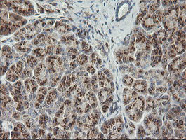 PIK3CG Antibody in Immunohistochemistry (Paraffin) (IHC (P))