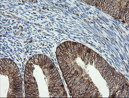 PIK3CG Antibody in Immunohistochemistry (Paraffin) (IHC (P))