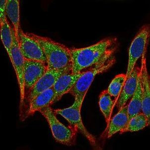 PI3K p85 alpha Antibody in Immunocytochemistry (ICC/IF)