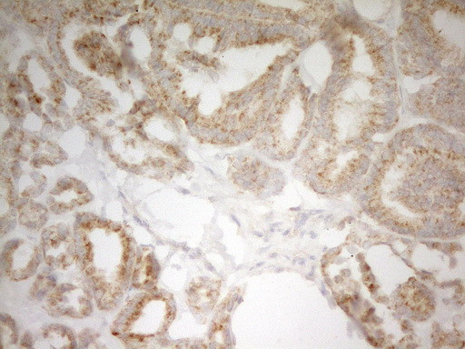 PIK3R4 Antibody in Immunohistochemistry (Paraffin) (IHC (P))