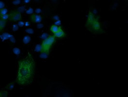 PIK3R5 Antibody in Immunocytochemistry (ICC/IF)