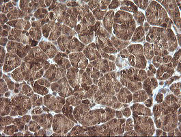 PIK3R5 Antibody in Immunohistochemistry (Paraffin) (IHC (P))