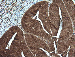 PIK3R5 Antibody in Immunohistochemistry (Paraffin) (IHC (P))