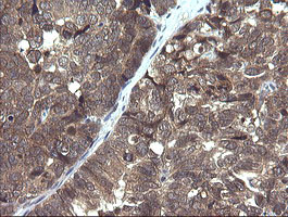 PIK3R5 Antibody in Immunohistochemistry (Paraffin) (IHC (P))