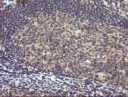 PIK3R5 Antibody in Immunohistochemistry (Paraffin) (IHC (P))