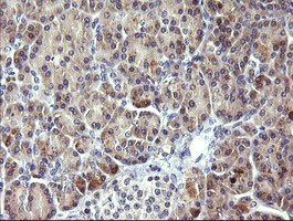 PIK3R5 Antibody in Immunohistochemistry (Paraffin) (IHC (P))