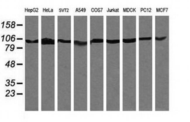 PIK3R5 Antibody in Western Blot (WB)