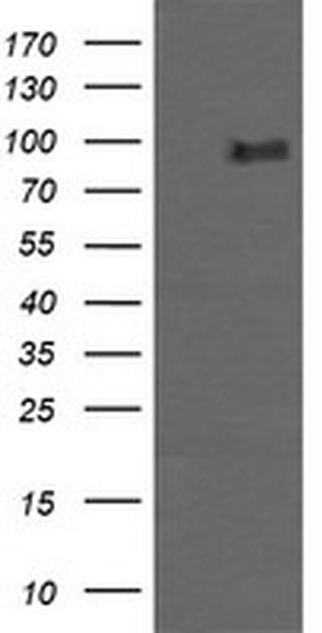 PIK3R5 Antibody in Western Blot (WB)