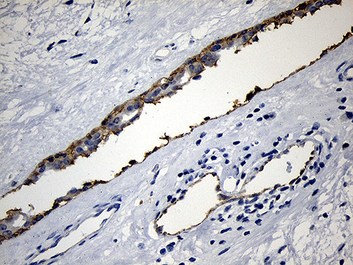 PIKFYVE Antibody in Immunohistochemistry (Paraffin) (IHC (P))