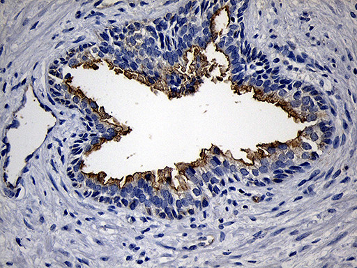 PIKFYVE Antibody in Immunohistochemistry (Paraffin) (IHC (P))