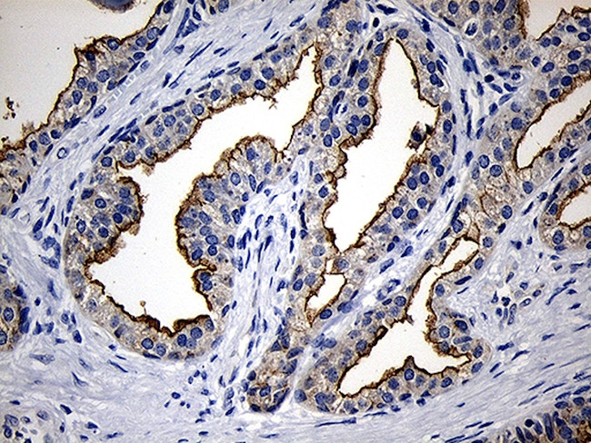 PIKFYVE Antibody in Immunohistochemistry (Paraffin) (IHC (P))