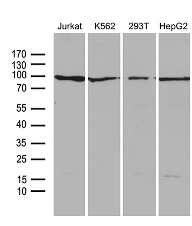 PIKFYVE Antibody in Western Blot (WB)