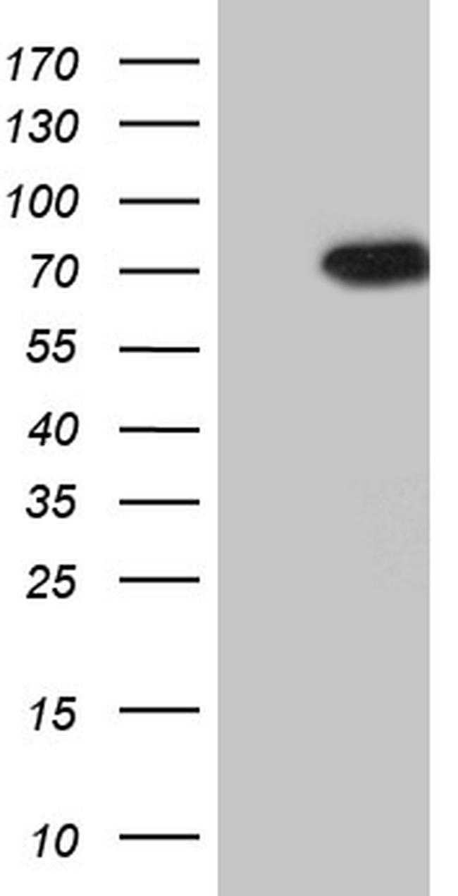 PIKFYVE Antibody in Western Blot (WB)