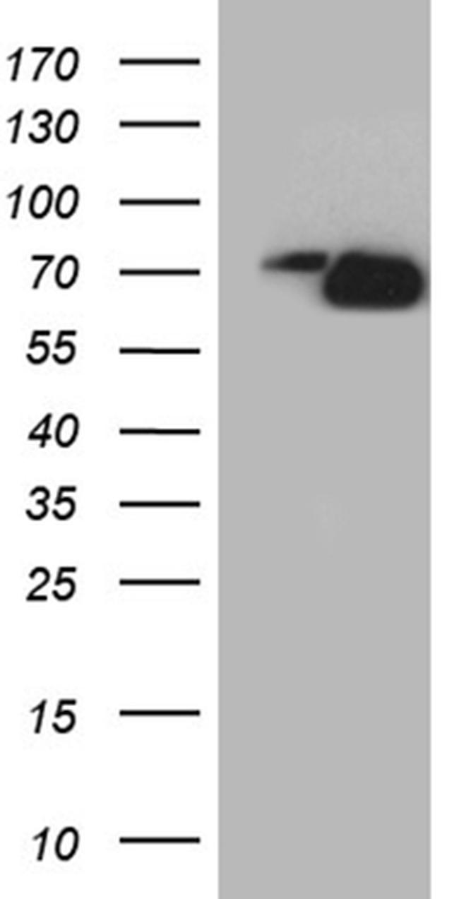 PIKFYVE Antibody in Western Blot (WB)