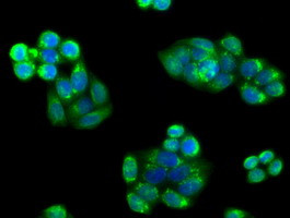 PIM2 Antibody in Immunocytochemistry (ICC/IF)