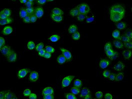 PIM2 Antibody in Immunocytochemistry (ICC/IF)