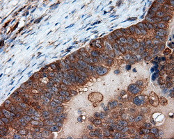 PIM2 Antibody in Immunohistochemistry (Paraffin) (IHC (P))