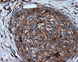 PIM2 Antibody in Immunohistochemistry (Paraffin) (IHC (P))