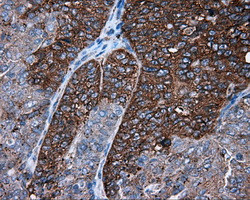 PIM2 Antibody in Immunohistochemistry (Paraffin) (IHC (P))