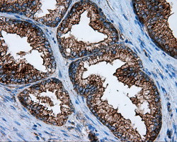 PIM2 Antibody in Immunohistochemistry (Paraffin) (IHC (P))