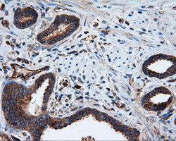 PIM2 Antibody in Immunohistochemistry (Paraffin) (IHC (P))