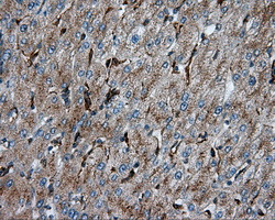 PIM2 Antibody in Immunohistochemistry (Paraffin) (IHC (P))