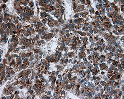 PIM2 Antibody in Immunohistochemistry (Paraffin) (IHC (P))