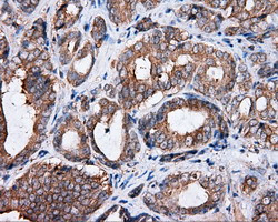 PIM2 Antibody in Immunohistochemistry (Paraffin) (IHC (P))