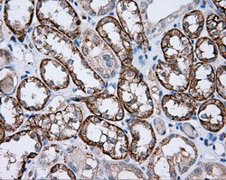 PIM2 Antibody in Immunohistochemistry (Paraffin) (IHC (P))