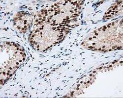 PIM2 Antibody in Immunohistochemistry (Paraffin) (IHC (P))