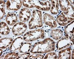 PIM2 Antibody in Immunohistochemistry (Paraffin) (IHC (P))