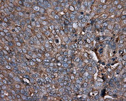 PIM2 Antibody in Immunohistochemistry (Paraffin) (IHC (P))