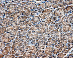 PIM2 Antibody in Immunohistochemistry (Paraffin) (IHC (P))