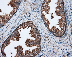 PIM2 Antibody in Immunohistochemistry (Paraffin) (IHC (P))