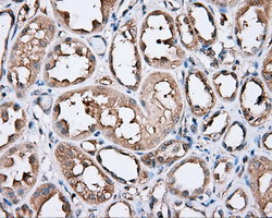 PIM2 Antibody in Immunohistochemistry (Paraffin) (IHC (P))