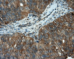 PIM2 Antibody in Immunohistochemistry (Paraffin) (IHC (P))