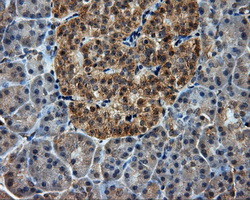 PIM2 Antibody in Immunohistochemistry (Paraffin) (IHC (P))