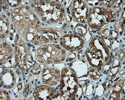 PIM2 Antibody in Immunohistochemistry (Paraffin) (IHC (P))